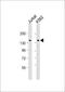 KN motif and ankyrin repeat domain-containing protein 1 antibody, M05029, Boster Biological Technology, Western Blot image 