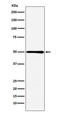 Hydroxymethylglutaryl-CoA synthase, mitochondrial antibody, M04371, Boster Biological Technology, Western Blot image 