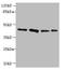RAD23 Homolog B, Nucleotide Excision Repair Protein antibody, A50444-100, Epigentek, Western Blot image 