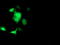 Suppressor Of Cytokine Signaling 3 antibody, TA503039, Origene, Immunofluorescence image 