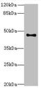 Arylacetamide Deacetylase Like 2 antibody, orb20212, Biorbyt, Western Blot image 
