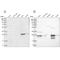GC-A antibody, PA5-57124, Invitrogen Antibodies, Western Blot image 