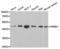 Nuclear receptor subfamily 0 group B member 1 antibody, LS-C335176, Lifespan Biosciences, Western Blot image 
