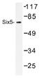 SIX Homeobox 5 antibody, AP01481PU-N, Origene, Western Blot image 