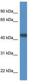 Paraneoplastic antigen-like protein 6A antibody, TA343035, Origene, Western Blot image 