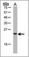 ADP Ribosylation Factor Like GTPase 2 antibody, AP23081PU-N, Origene, Western Blot image 