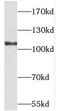 Cadherin-4 antibody, FNab07200, FineTest, Western Blot image 