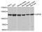 Ubiquitin Specific Peptidase 26 antibody, A07732, Boster Biological Technology, Western Blot image 