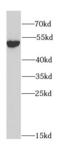 ALDH2 antibody, FNab00291, FineTest, Western Blot image 