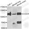 Very Low Density Lipoprotein Receptor antibody, A7345, ABclonal Technology, Western Blot image 