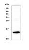 Spasmolytic polypeptide antibody, A07013-1, Boster Biological Technology, Western Blot image 