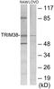 Tripartite Motif Containing 38 antibody, EKC1619, Boster Biological Technology, Western Blot image 