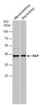 LDL Receptor Related Protein Associated Protein 1 antibody, GTX104033, GeneTex, Western Blot image 