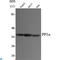 Protein Phosphatase 1 Catalytic Subunit Alpha antibody, LS-C813082, Lifespan Biosciences, Western Blot image 