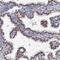 Chromosome 11 Open Reading Frame 96 antibody, PA5-58561, Invitrogen Antibodies, Immunohistochemistry paraffin image 