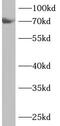 Ankyrin repeat and sterile alpha motif domain-containing protein 1B antibody, FNab00422, FineTest, Western Blot image 