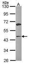Acetyl-CoA Acyltransferase 1 antibody, GTX114230, GeneTex, Western Blot image 