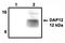Calcium Voltage-Gated Channel Auxiliary Subunit Gamma 4 antibody, orb108862, Biorbyt, Immunoprecipitation image 
