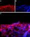 Sodium Voltage-Gated Channel Beta Subunit 1 antibody, PA5-77741, Invitrogen Antibodies, Immunohistochemistry paraffin image 