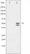 Vasodilator Stimulated Phosphoprotein antibody, TA325966, Origene, Western Blot image 