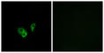 Cyclic Nucleotide Gated Channel Alpha 2 antibody, abx014401, Abbexa, Western Blot image 