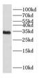 Protein Phosphatase 1 Regulatory Inhibitor Subunit 1B antibody, FNab02244, FineTest, Western Blot image 