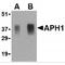 Gamma-secretase subunit APH-1A antibody, MBS150727, MyBioSource, Western Blot image 