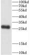 Centrosomal Protein 70 antibody, FNab01608, FineTest, Western Blot image 