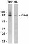 Interleukin 1 Receptor Associated Kinase 1 antibody, SP1187P, Origene, Western Blot image 