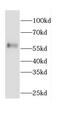 Calcium/Calmodulin Dependent Protein Kinase Kinase 2 antibody, FNab01238, FineTest, Western Blot image 