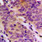 Aldo-keto reductase family 1 member C1 antibody, LS-C353965, Lifespan Biosciences, Immunohistochemistry paraffin image 