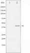 SAPK2A antibody, TA325654, Origene, Western Blot image 
