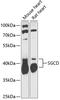 Sarcoglycan Delta antibody, A05297, Boster Biological Technology, Western Blot image 
