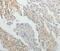 Spermatogenesis Associated 17 antibody, MBS2526616, MyBioSource, Immunohistochemistry paraffin image 