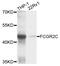 Fc Fragment Of IgG Receptor IIc (Gene/Pseudogene) antibody, abx135980, Abbexa, Western Blot image 