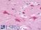  antibody, LS-B9733, Lifespan Biosciences, Immunohistochemistry paraffin image 