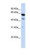 HEPACAM Family Member 2 antibody, NBP1-91588, Novus Biologicals, Western Blot image 
