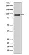 Sp1 Transcription Factor antibody, M00110, Boster Biological Technology, Western Blot image 