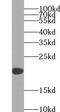 PBR antibody, FNab10473, FineTest, Western Blot image 