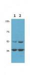 Cyclin Dependent Kinase 9 antibody, TA319415, Origene, Western Blot image 