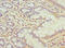 Membrane-bound transcription factor site-1 protease antibody, LS-C676027, Lifespan Biosciences, Immunohistochemistry paraffin image 