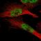Zinc Finger And BTB Domain Containing 11 antibody, HPA015328, Atlas Antibodies, Immunofluorescence image 