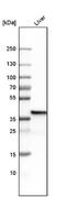 FBP antibody, NBP1-84721, Novus Biologicals, Western Blot image 