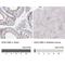 KIAA1586 antibody, NBP1-86291, Novus Biologicals, Immunohistochemistry paraffin image 
