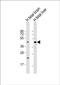 Solute Carrier Family 30 Member 10 antibody, PA5-49188, Invitrogen Antibodies, Western Blot image 