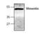 Vimentin antibody, AP00289PU-N, Origene, Western Blot image 