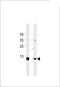 Myoglobin antibody, LS-C158346, Lifespan Biosciences, Western Blot image 