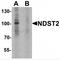 N-Deacetylase And N-Sulfotransferase 2 antibody, TA349066, Origene, Western Blot image 