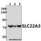 Solute Carrier Family 22 Member 3 antibody, A04914, Boster Biological Technology, Western Blot image 
