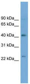 ATPase Phospholipid Transporting 8B2 antibody, TA336164, Origene, Western Blot image 